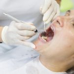Cause e cura della parodontosi